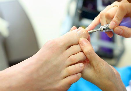 toe treatment