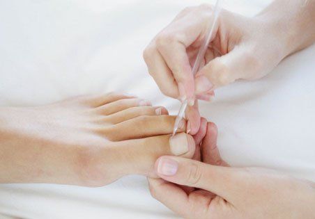corrective nail surgery