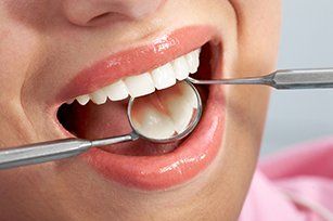 Teeth cleanings—Woman having Regular Check up in Sacramento, CA Teeth cleanings—Woman having Regular Check up in Sacramento, CA