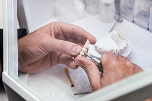 Veneers — Veneers in Sacramento, CA Veneers — Veneers in Sacramento, CA