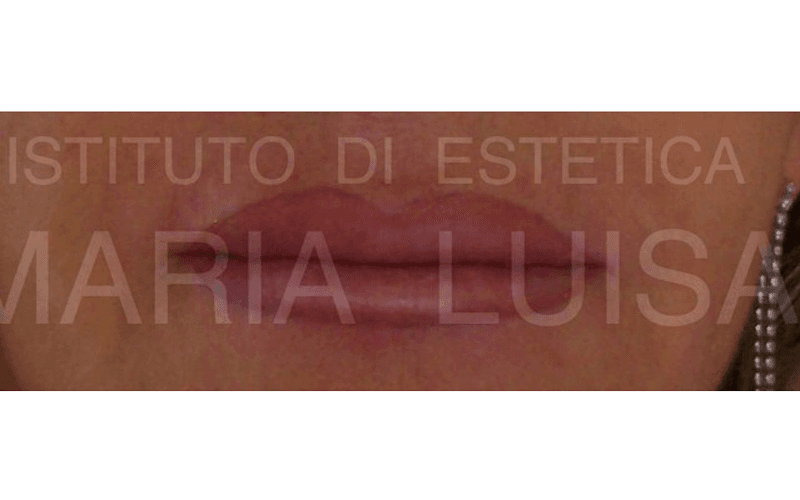 Correzione effettuata