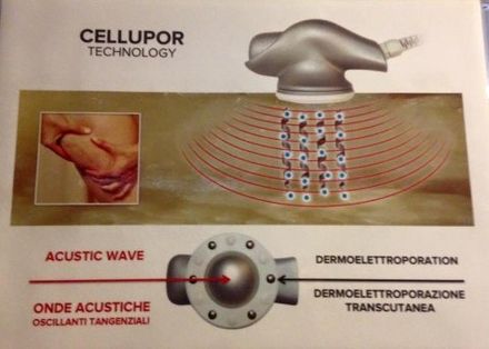 cellupor promozione cellupor promozione