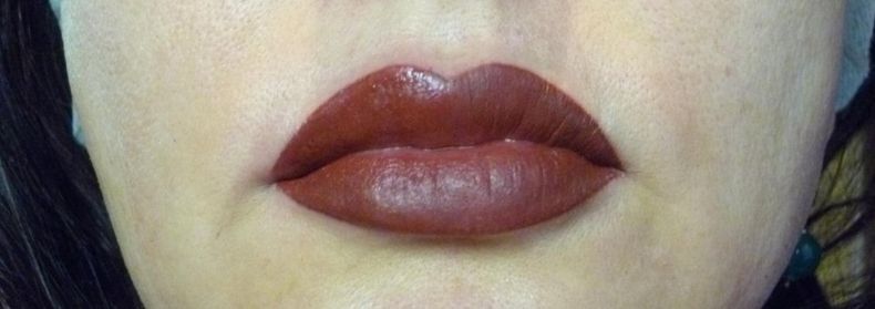 labbra dopo ricostruzione con effetto rossetto