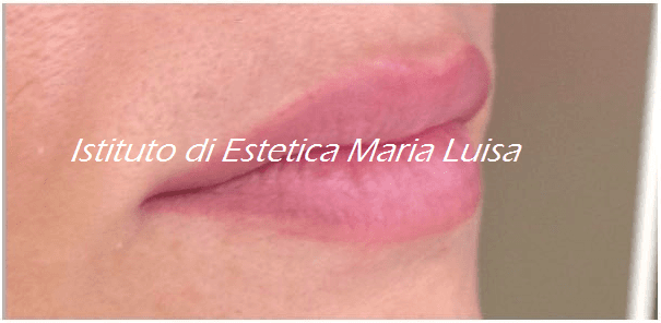 Labbra dopo ricostruzione con sfumatura effetto naturale