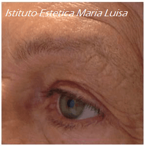 Prima