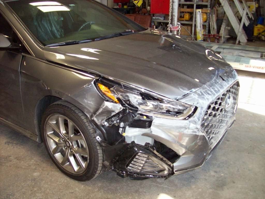 Sonata Before — Oklahoma City, OK — Freeman Collision Center
