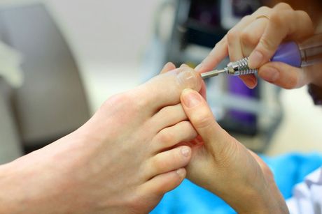 Toe Nail Treatment