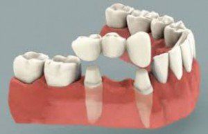 Patient Looking at Her Teeth—Restorative Dentistry in Lake Wylie, SC Patient Looking at Her Teeth—Restorative Dentistry in Lake Wylie, SC