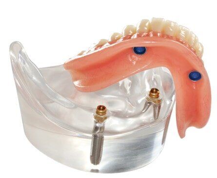 A Pair of Dentures—Restorative Dentistry in Lake Wylie, SC A Pair of Dentures—Restorative Dentistry in Lake Wylie, SC