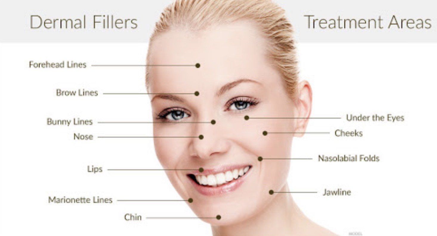 Active acne therapy