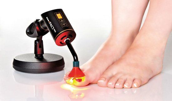 fungal nail treatments craig boulton podiatry fungal nail treatments