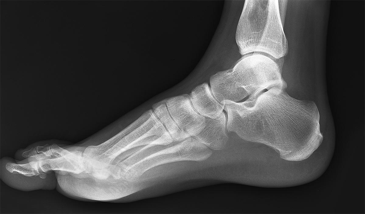 diagnosis craig boulton podiatry diagnosis