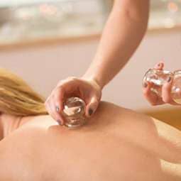 Cupping Therapy - Cupping in Naples, FL