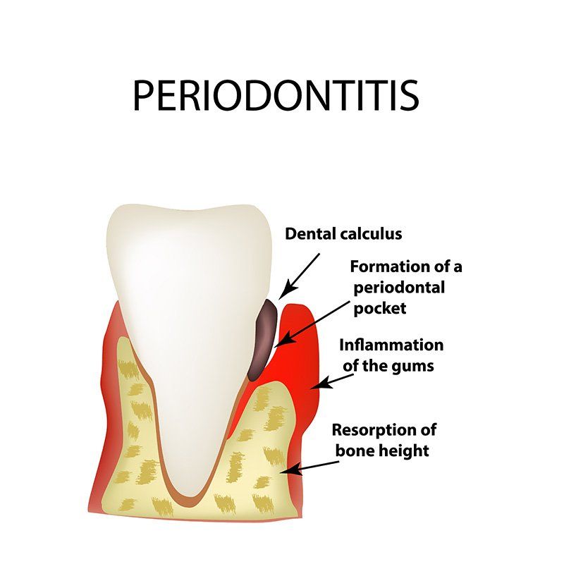 Gentle Touch Family Dentistry - General Dentistry