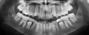 Gentle Touch Family Dentistry - Digital Panorex Machine Xray