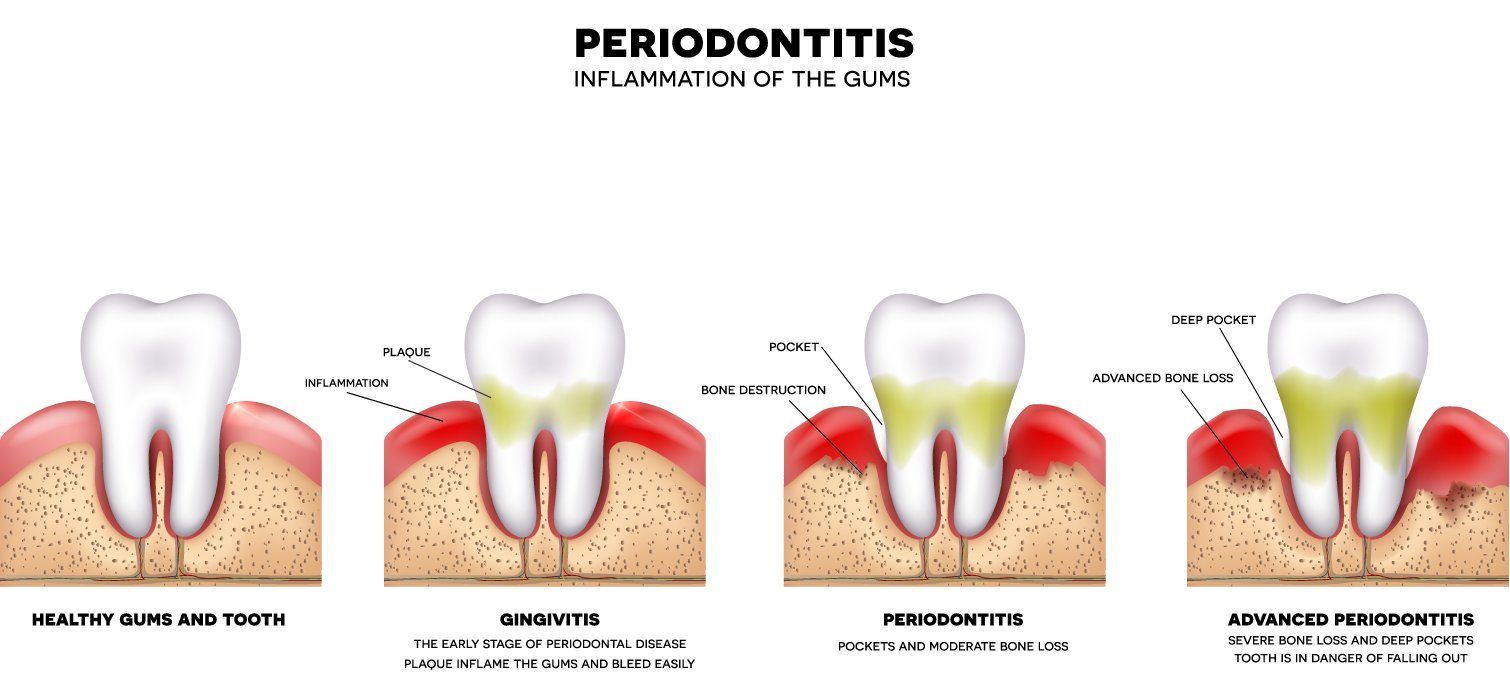 Gentle Touch Family Dentistry - Dental Cleaning