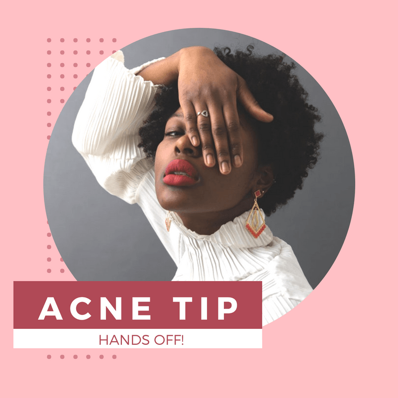 Acne Tip: Hands Off!