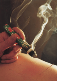 Moxibustion