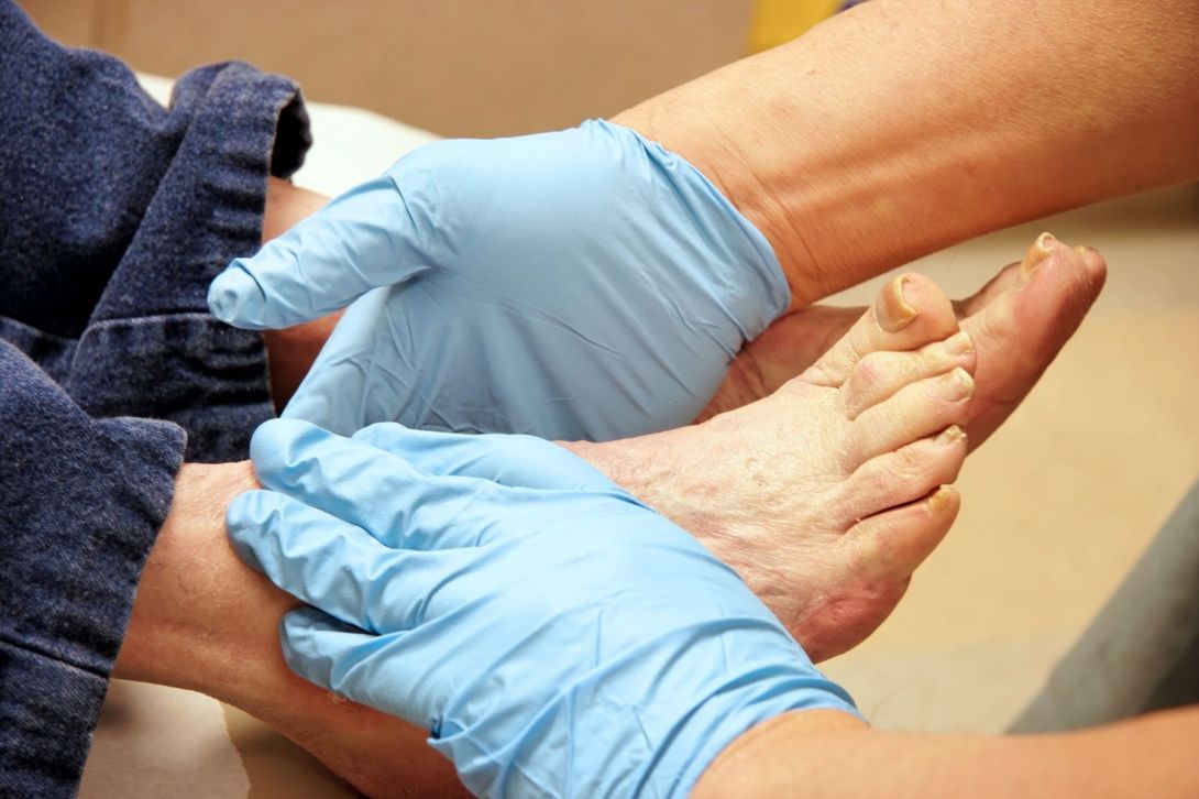 Cura mal di piedi