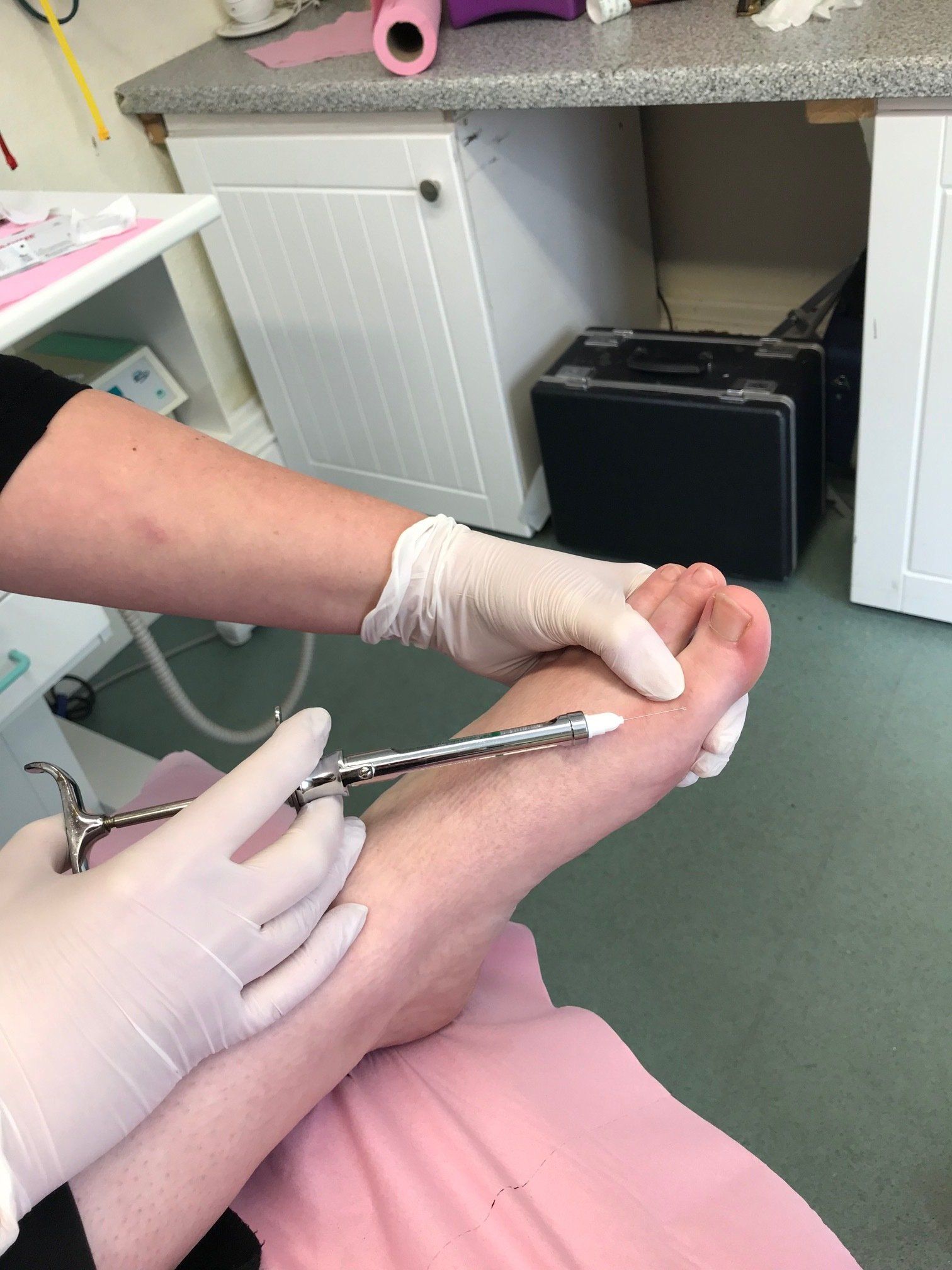 Nail surgery 1