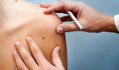 Doctor Examining Patient's Birthmark — Charleston, WV — H. Richard Reynolds, M.D. Doctor Examining Patient's Birthmark — Charleston, WV — H. Richard Reynolds, M.D.