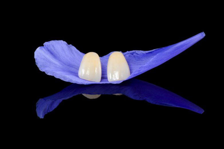 dental porcelain veneers set against a blue flower