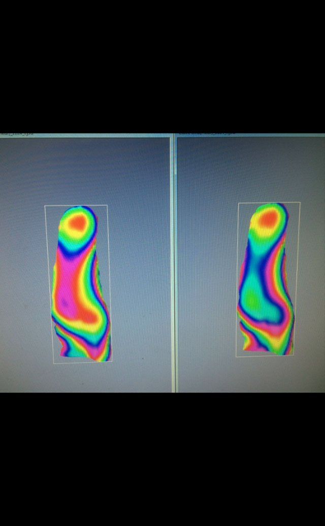 foot temp