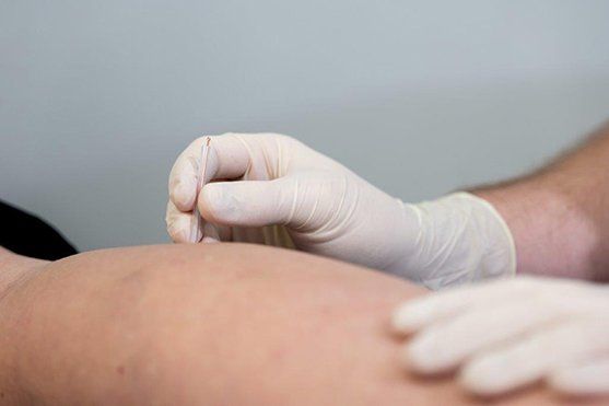Hand putting a needle in  legs
