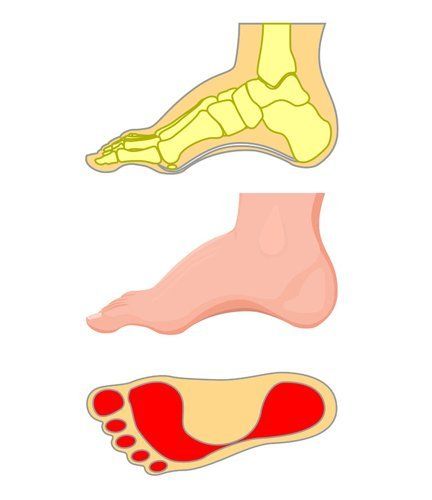 high arched feet