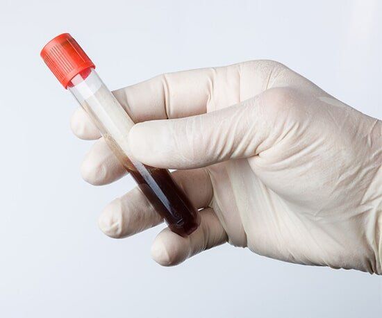 Testing Kit — Drug Testing And Training Solutions in Rockhampton, QLD