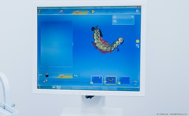 Intraoraler 3D-Scanner statt Abformungen