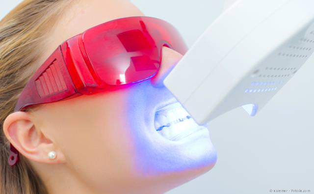 Power-Bleaching: Schnelle Zahnaufhellung in der Praxis mit einer speziellen Bleaching-Lampe Power-Bleaching: Schnelle Zahnaufhellung in der Praxis mit einer speziellen Bleaching-Lampe