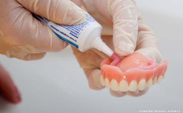 Implantate können schlecht haltenden Totalprothesen einen sicheren Sitz geben oder sie ganz ersetzen
