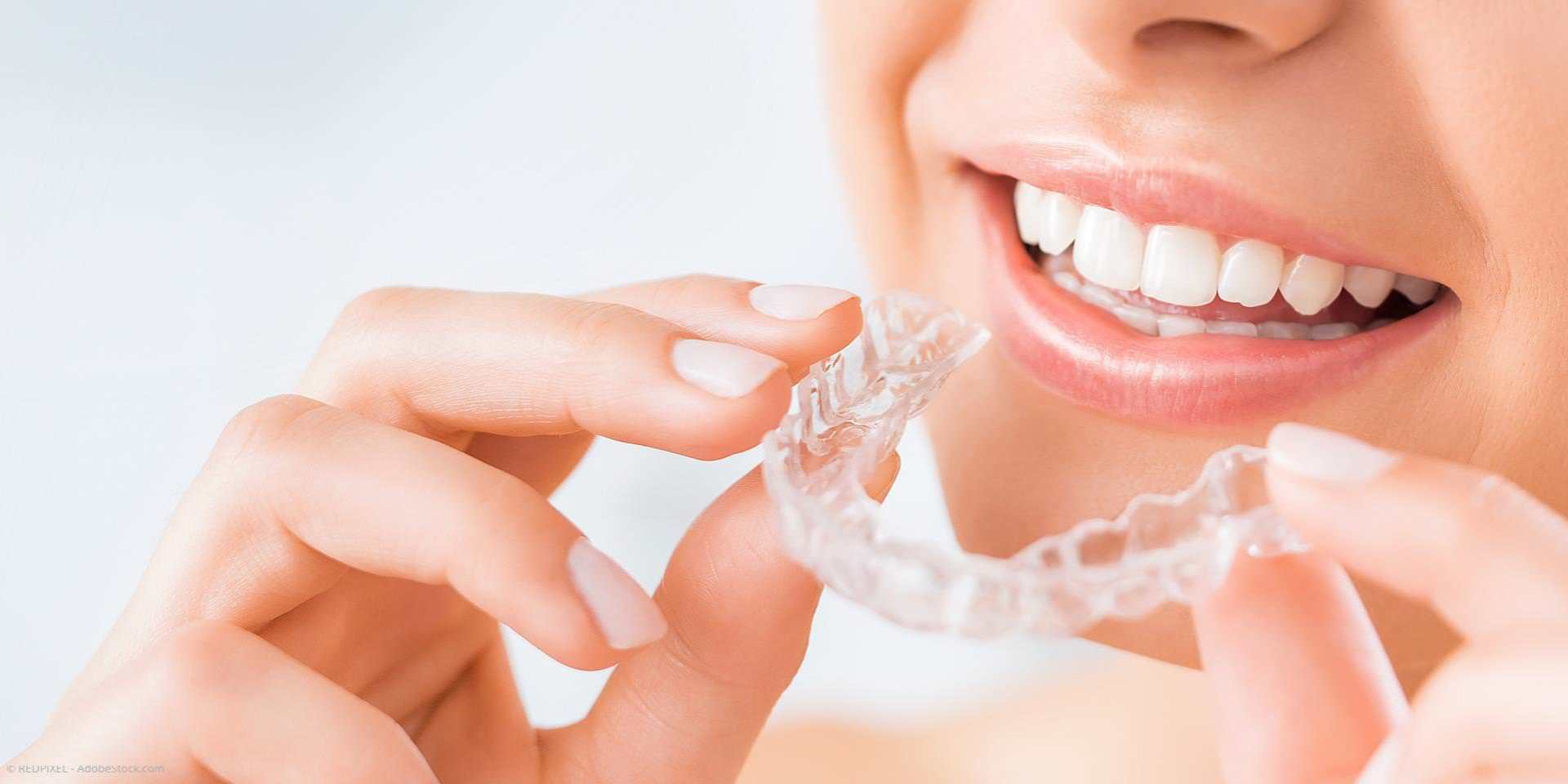 Aligner: Unsichtbare Zahnregulierung mit transparenten Folien