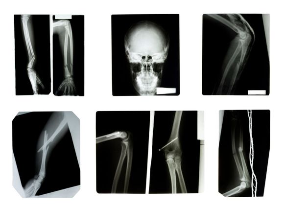 trattamento delle patologie ortopediche