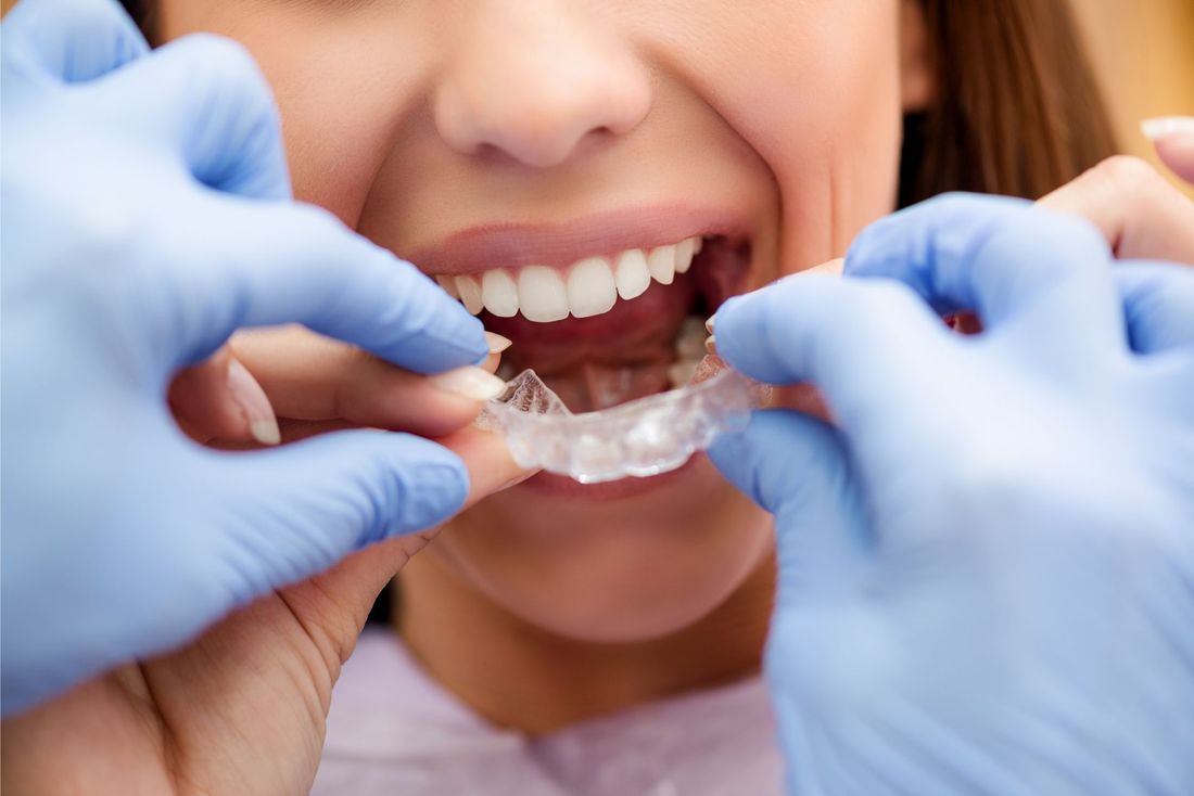 Forma dentale in cera