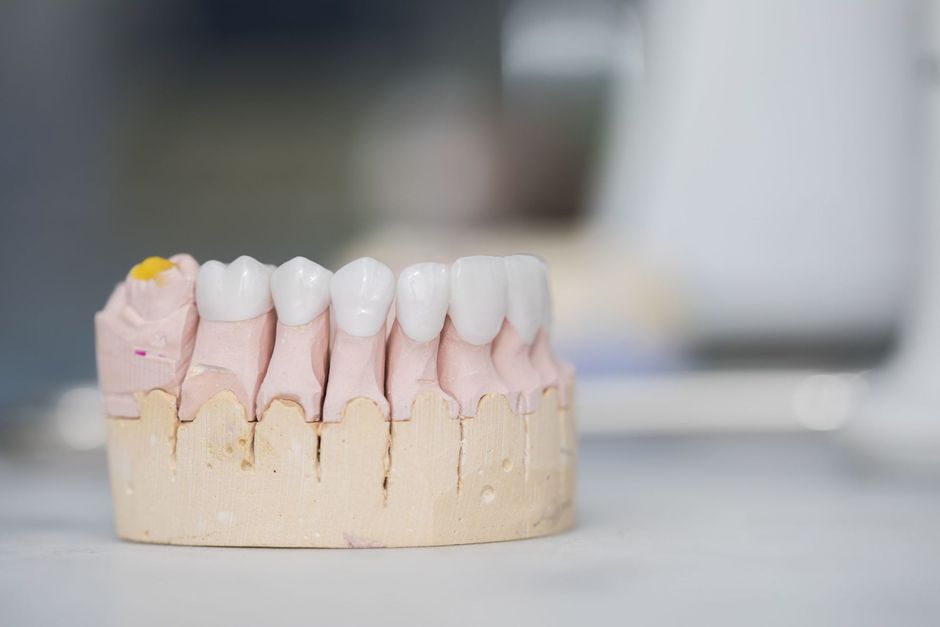 Calco arcata dentale