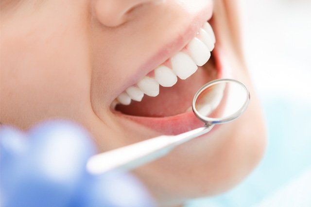 smile tooth mirror dentist looking at patient teeth with hand mirror