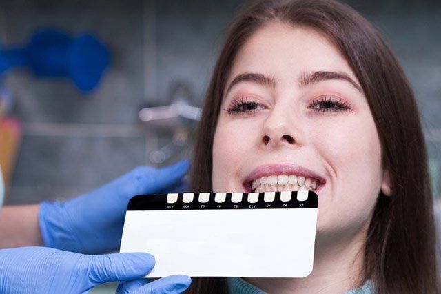veneers matching colours for veneers