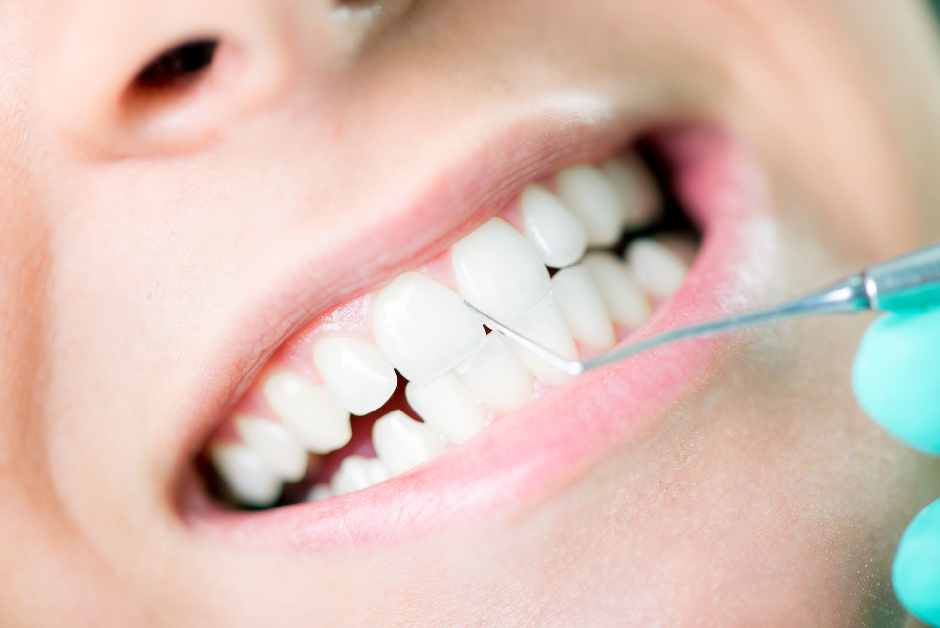 Dental examination