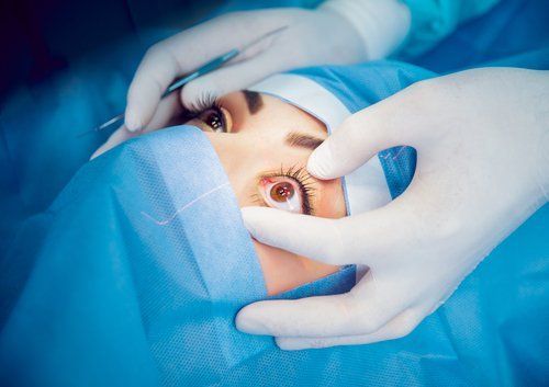 intervento oculistico laser