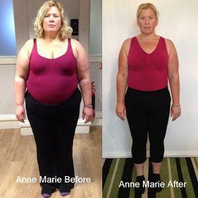 Patient Anne Marie