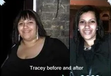 Patient Tracey