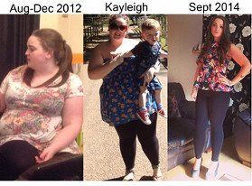Patient Kayleigh