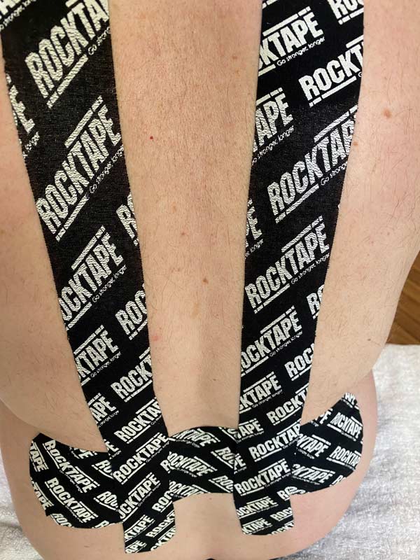 myofacial taping