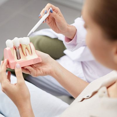 Dentist Explaining Dental Implants — Hickory, NC — McDonald Family Dentistry Dentist Explaining Dental Implants — Hickory, NC — McDonald Family Dentistry