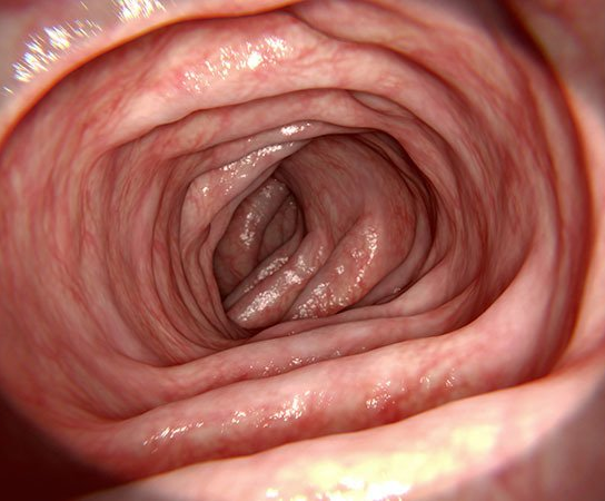 clean colon bowl prep colonoscopy