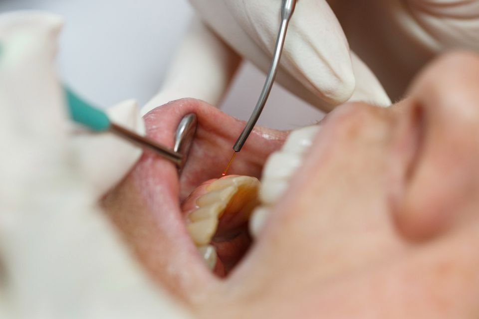 Trattamento odontoiatrico