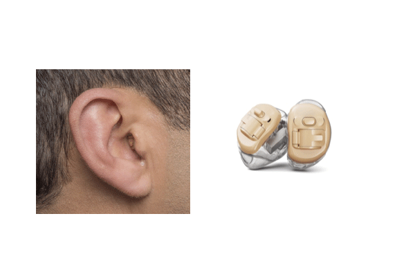 Hearing Aid Phonak