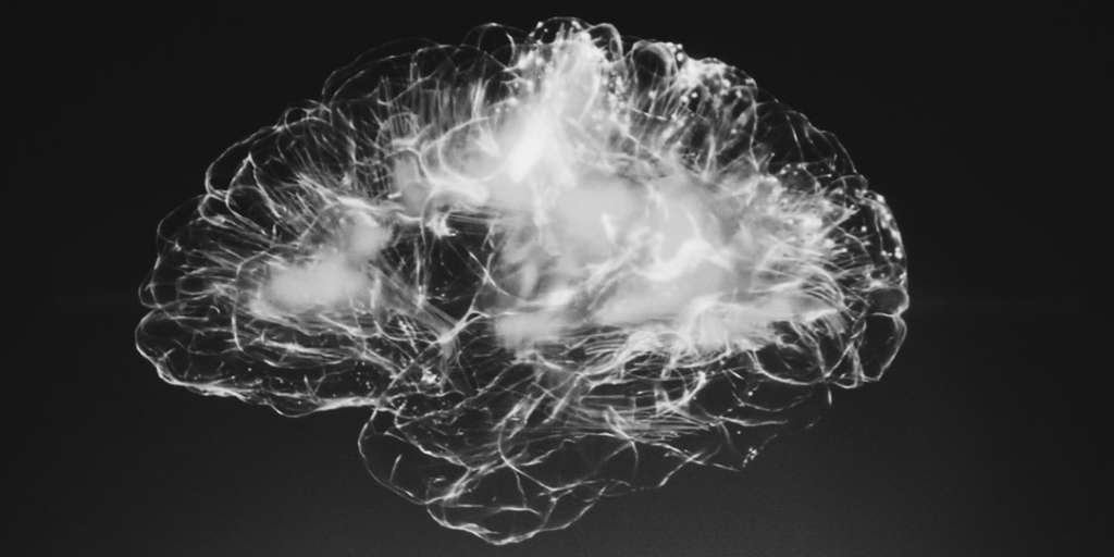 brain scan